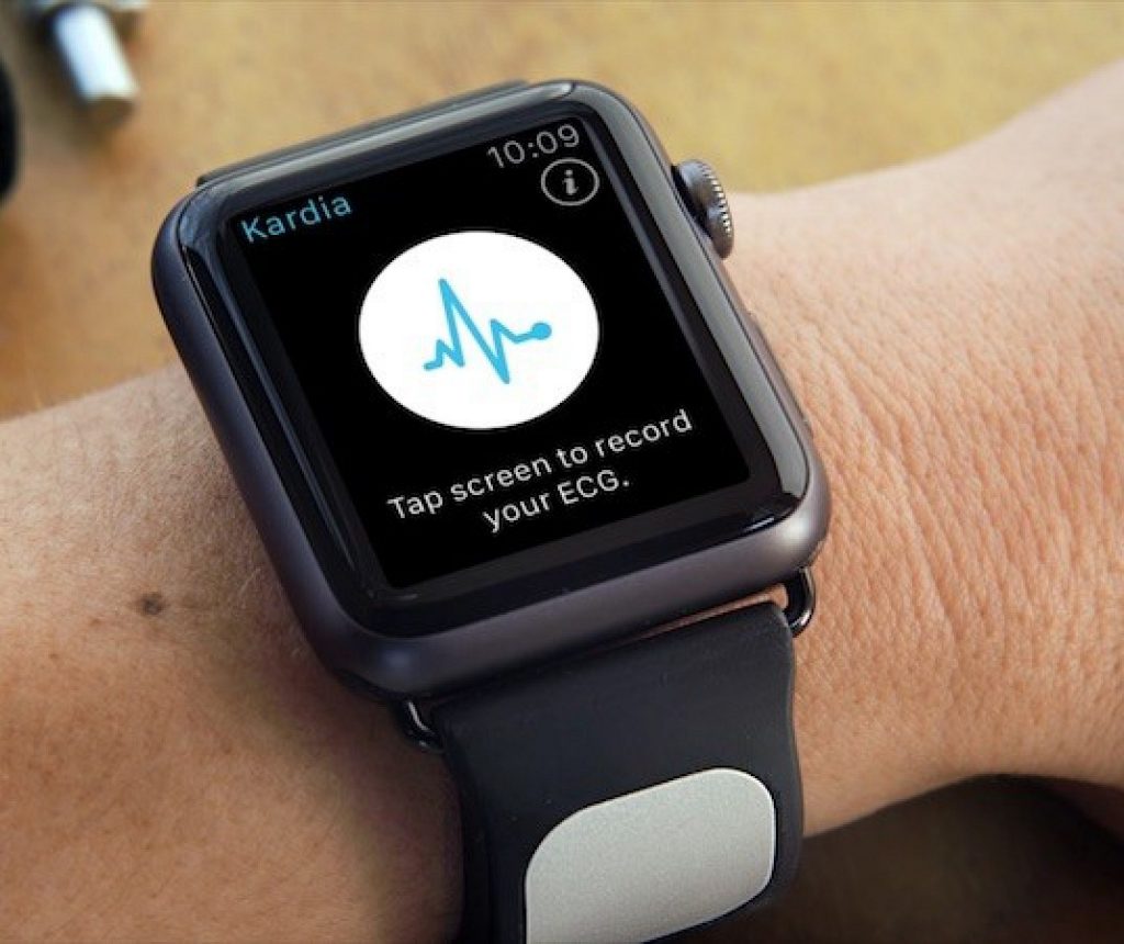 Obtener datos de ECG en Apple Watch usando Kardia