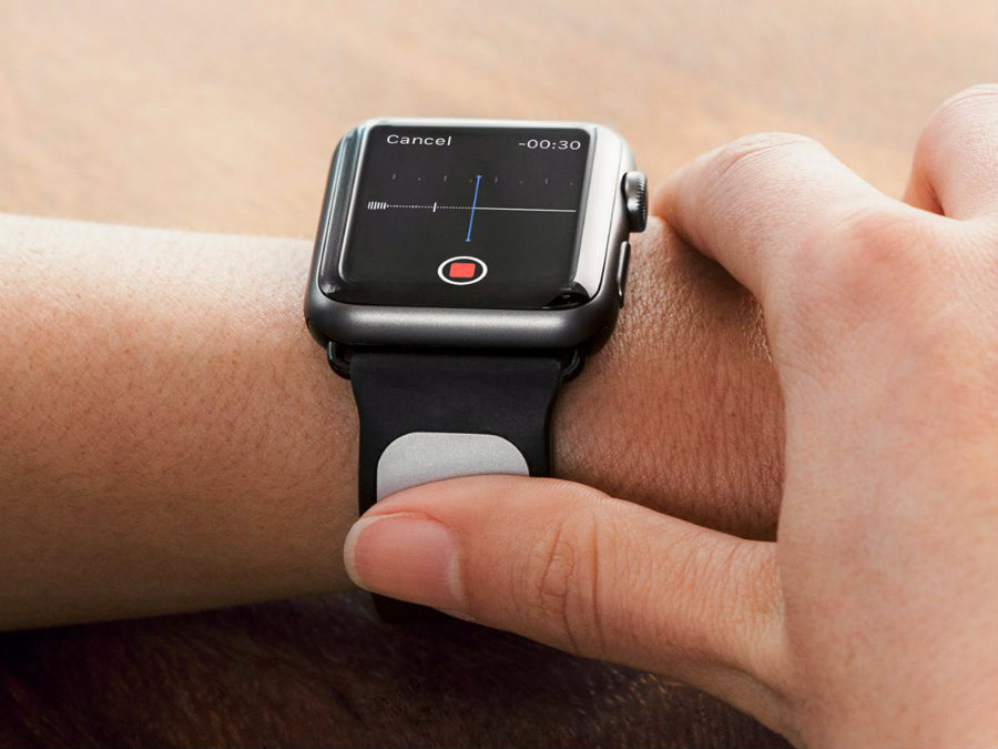 الحصول على بيانات ECG على Apple Watch باستخدام Kardia